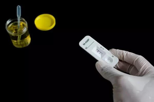 Getting A Negative Drug Testing Result to Return to Work